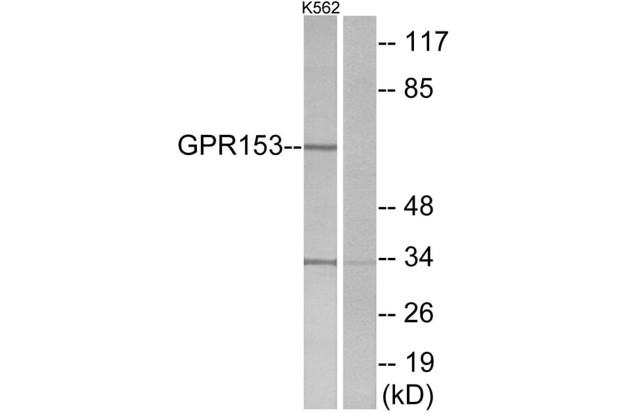 Western Blot - Anti-GPR153 Antibody (G304) - Antibodies.com