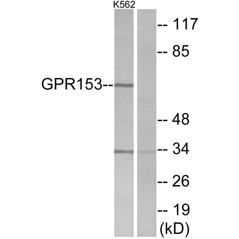 Western Blot - Anti-GPR153 Antibody (G304) - Antibodies.com