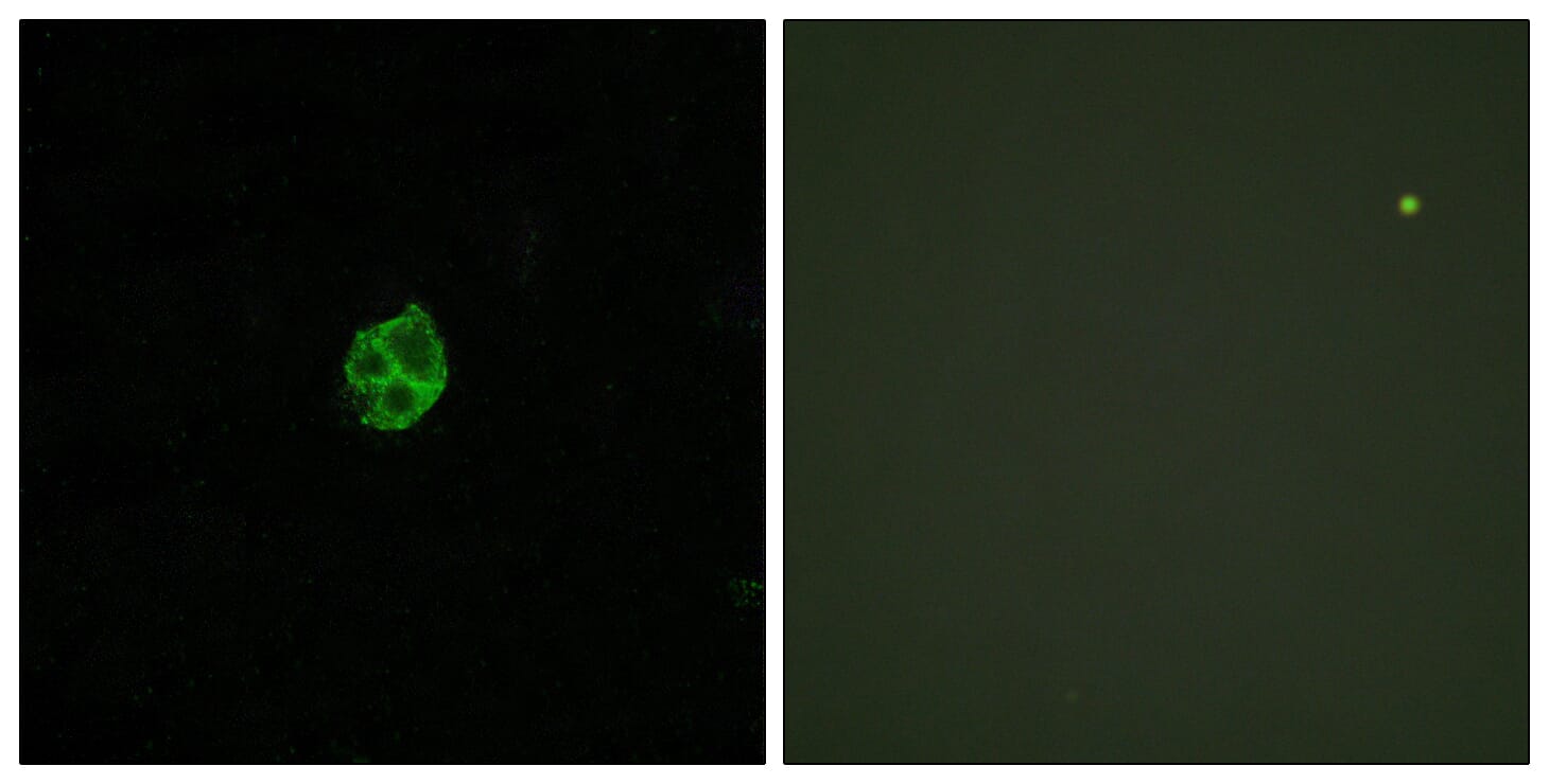 Immunofluorescence analysis of HUVEC cells using Anti-GPR151 Antibody. The right hand panel represents a negative control, where the antibody was pre-incubated with the immunising peptide.