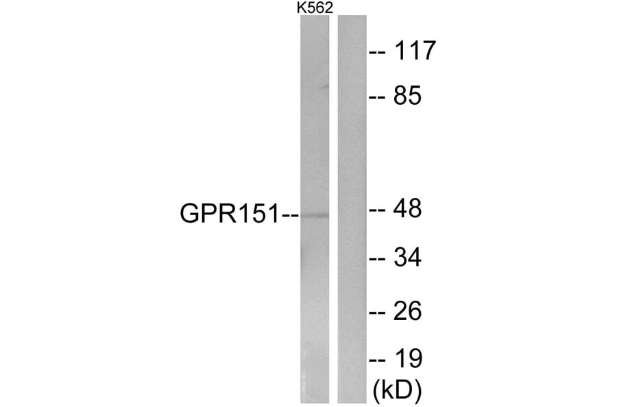 Western Blot - Anti-GPR151 Antibody (G302) - Antibodies.com