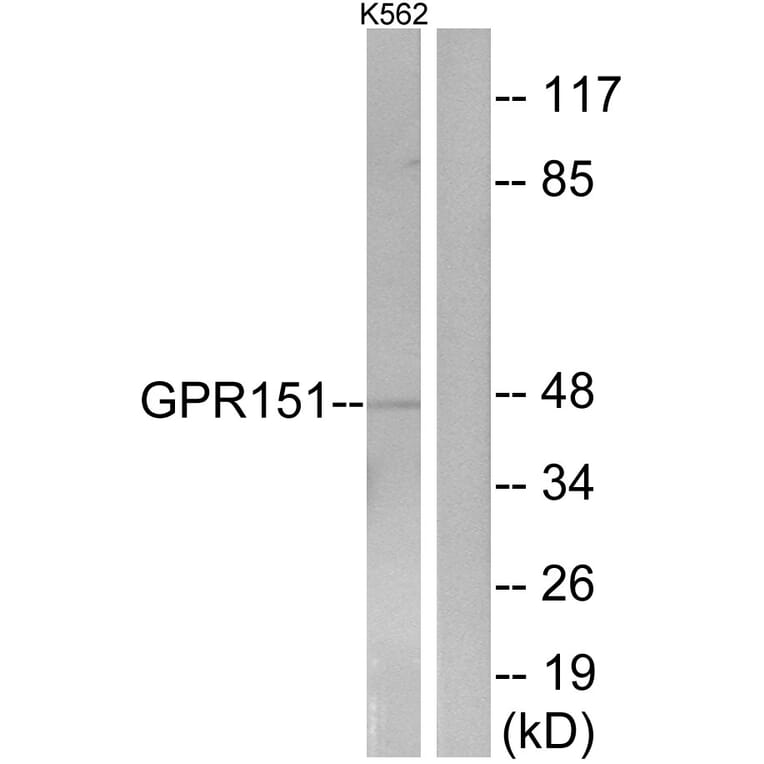 Western Blot - Anti-GPR151 Antibody (G302) - Antibodies.com