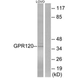 Western Blot - Anti-GPR120 Antibody (G127) - Antibodies.com