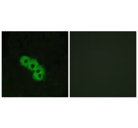 Immunofluorescence - Anti-GPR109 Antibody (G121) - Antibodies.com