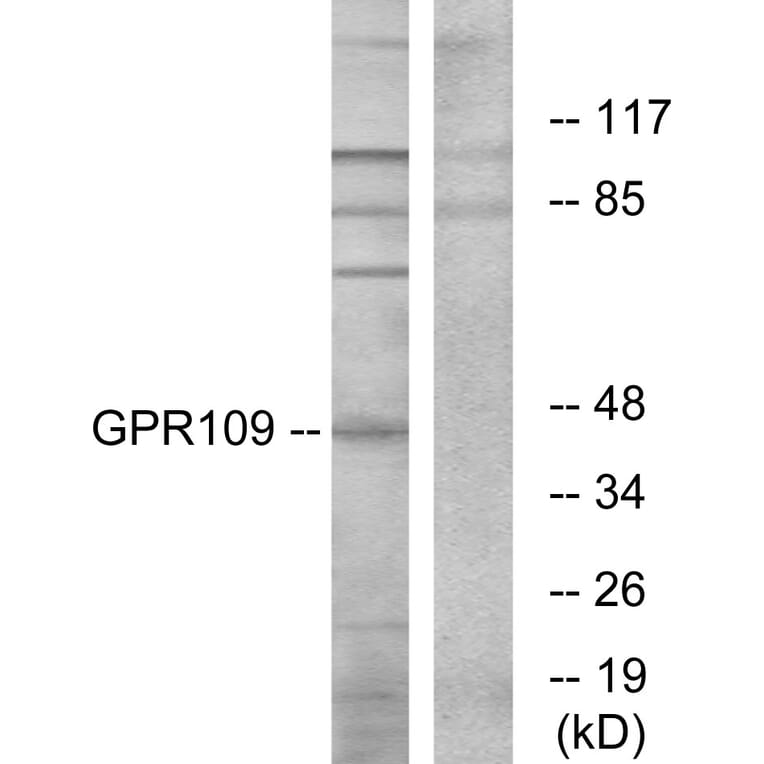 Western Blot - Anti-GPR109 Antibody (G121) - Antibodies.com