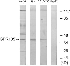 Western Blot - Anti-GPR105 Antibody (G120) - Antibodies.com