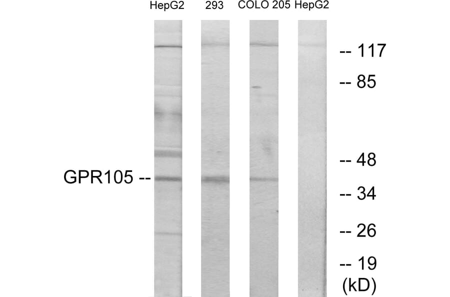 Western Blot - Anti-GPR105 Antibody (G120) - Antibodies.com