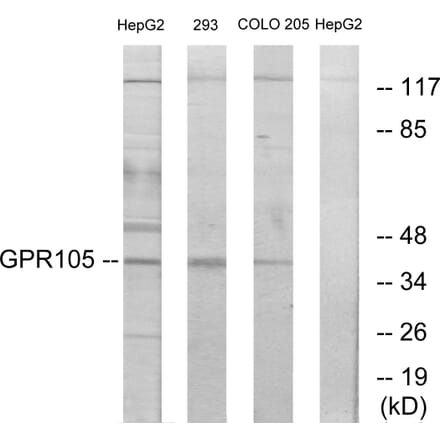 Western Blot - Anti-GPR105 Antibody (G120) - Antibodies.com