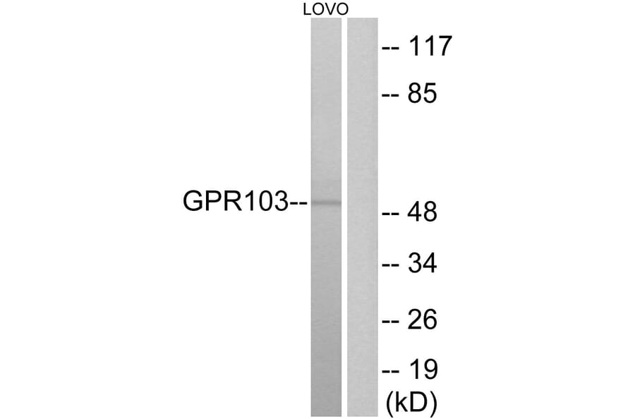 Western Blot - Anti-GPR103 Antibody (G734) - Antibodies.com