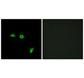 Immunofluorescence - Anti-GABBR1 Antibody (G266) - Antibodies.com
