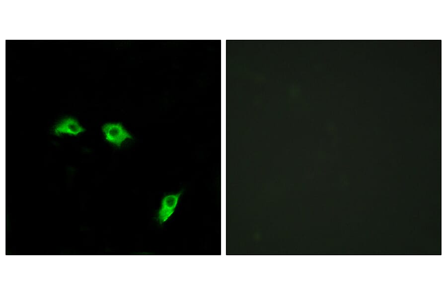 Immunofluorescence - Anti-GABBR1 Antibody (G266) - Antibodies.com
