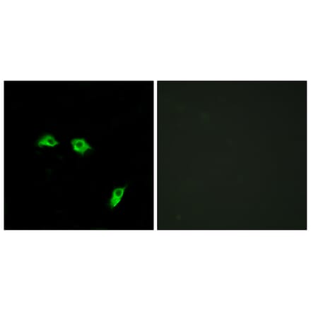 Immunofluorescence - Anti-GABBR1 Antibody (G266) - Antibodies.com