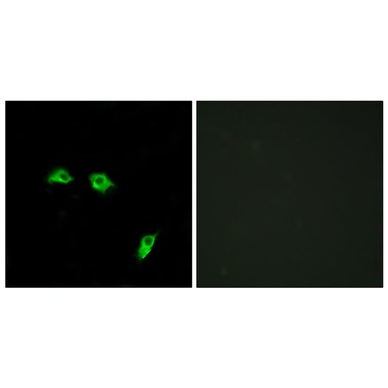 Immunofluorescence - Anti-GABBR1 Antibody (G266) - Antibodies.com