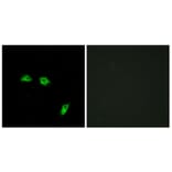 Immunofluorescence - Anti-GABBR1 Antibody (G266) - Antibodies.com