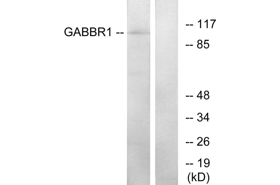 Western Blot - Anti-GABBR1 Antibody (G266) - Antibodies.com