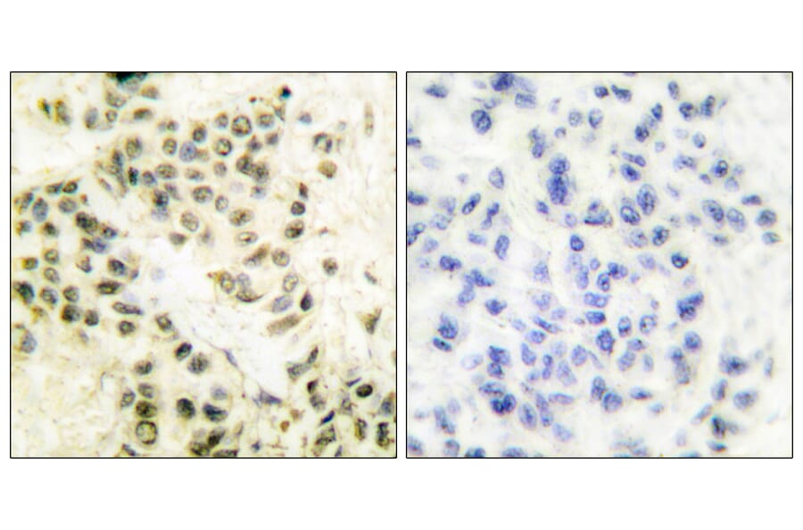 Immunohistochemistry - Anti-DNA-PK Antibody (C0174) - Antibodies.com