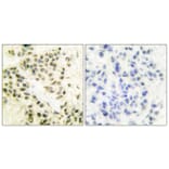 Immunohistochemistry - Anti-DNA-PK Antibody (C0174) - Antibodies.com