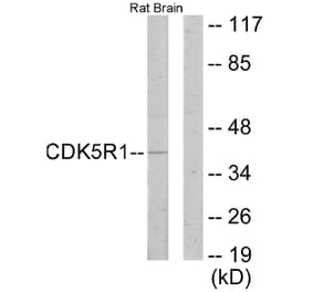 Western Blot - Anti-CDK5R1 Antibody (C11065) - Antibodies.com