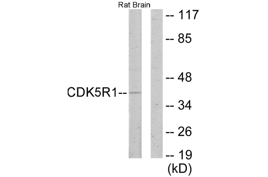 Western Blot - Anti-CDK5R1 Antibody (C11065) - Antibodies.com