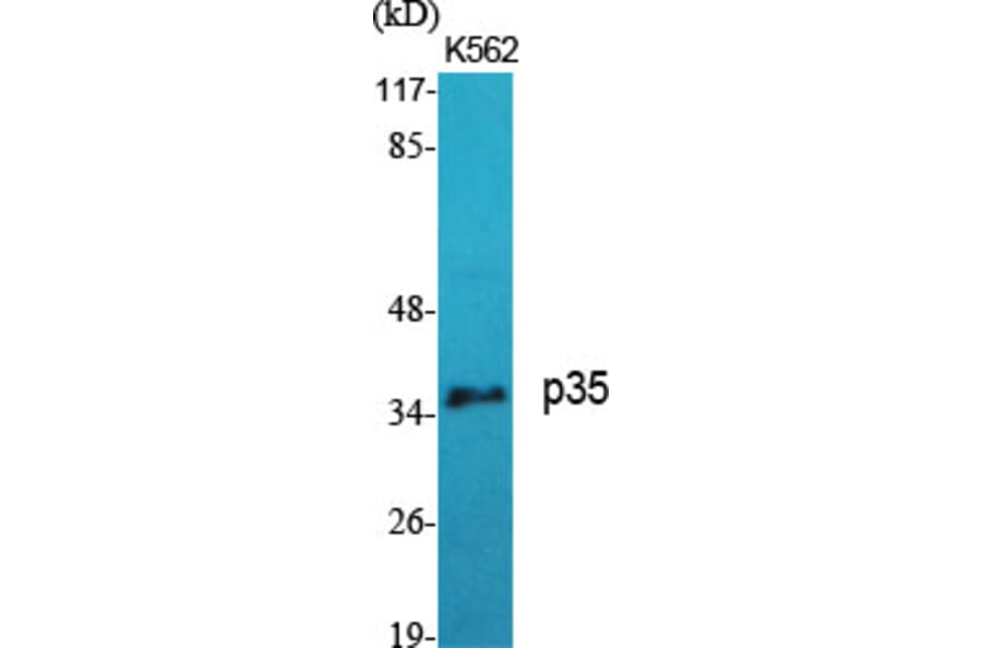 Western Blot - Anti-CDK5R1 Antibody (C11065) - Antibodies.com