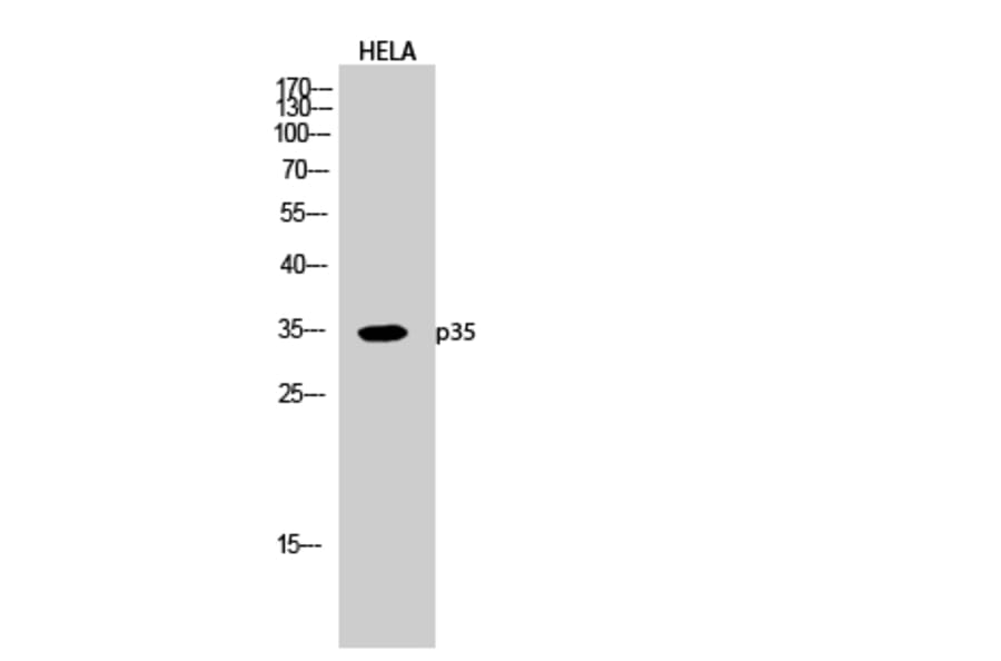 Western Blot - Anti-CDK5R1 Antibody (C11065) - Antibodies.com