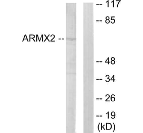 Western Blot - Anti-ARMCX2 Antibody (C11250) - Antibodies.com