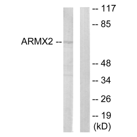 Western Blot - Anti-ARMCX2 Antibody (C11250) - Antibodies.com