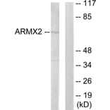 Western Blot - Anti-ARMCX2 Antibody (C11250) - Antibodies.com