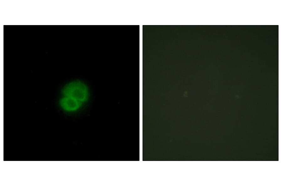 Immunofluorescence - Anti-ARMCX2 Antibody (C11250) - Antibodies.com