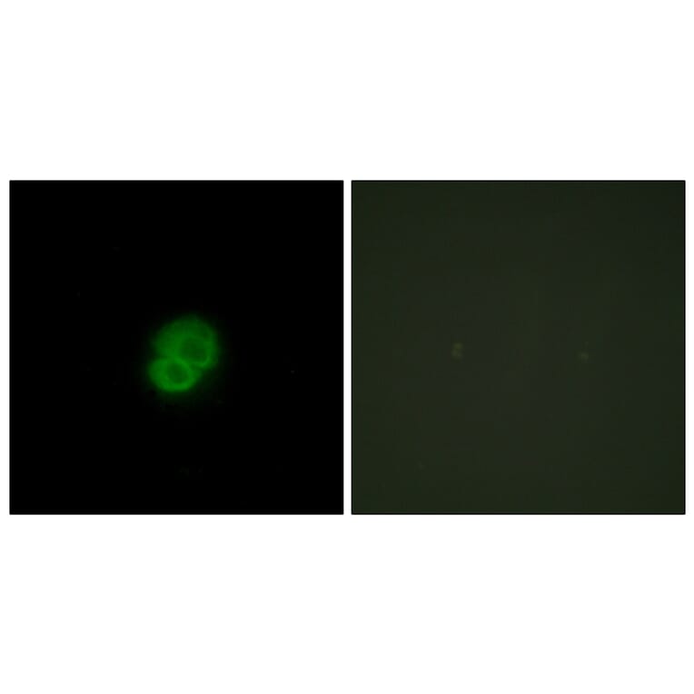 Immunofluorescence - Anti-ARMCX2 Antibody (C11250) - Antibodies.com