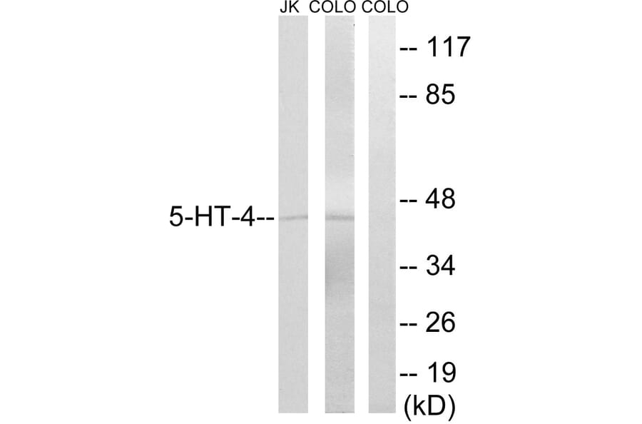Western Blot - Anti-5-HT-4 Antibody (C12017) - Antibodies.com