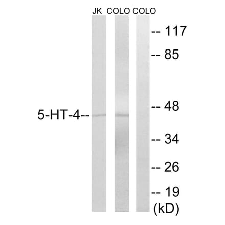 Western Blot - Anti-5-HT-4 Antibody (C12017) - Antibodies.com