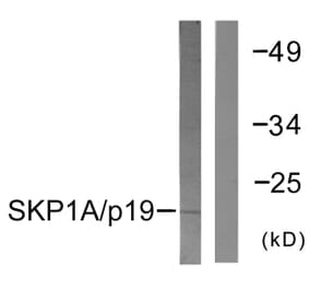 Western Blot - Anti-SKP1A Antibody (C0323) - Antibodies.com