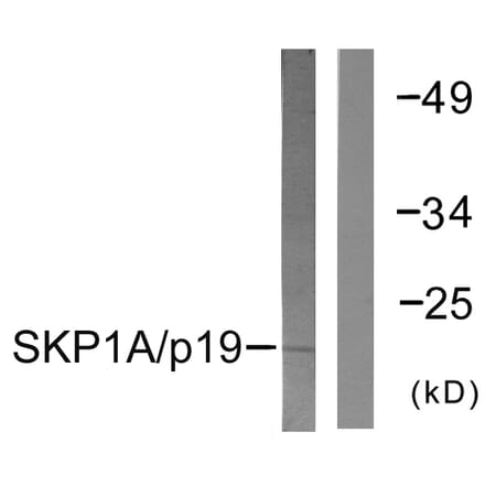 Western Blot - Anti-SKP1A Antibody (C0323) - Antibodies.com