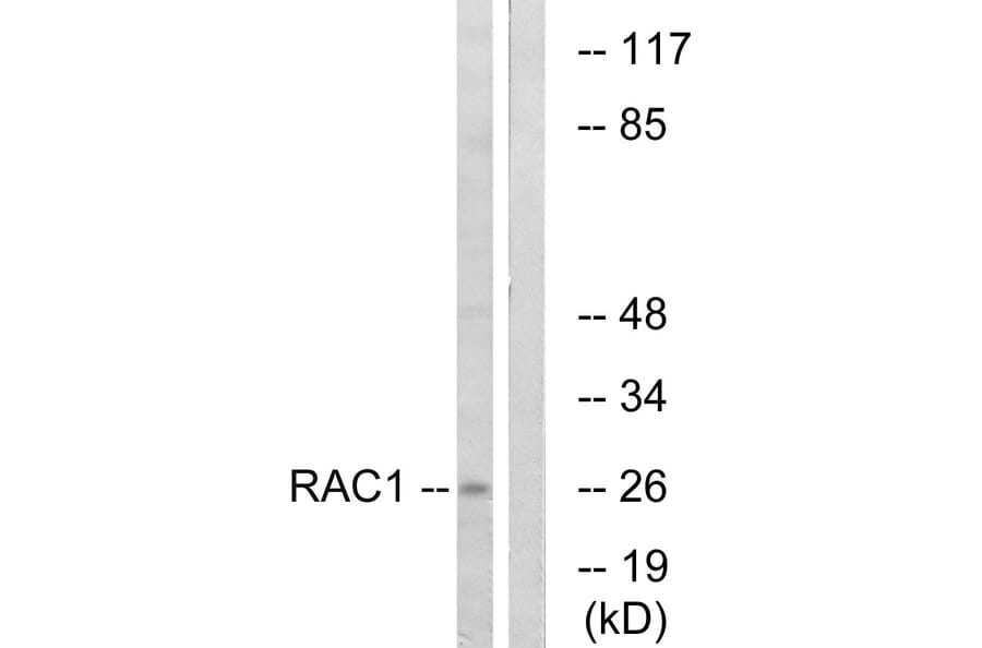 Western Blot - Anti-CDC42 Antibody (B7205) - Antibodies.com