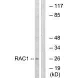 Western Blot - Anti-CDC42 Antibody (B7205) - Antibodies.com
