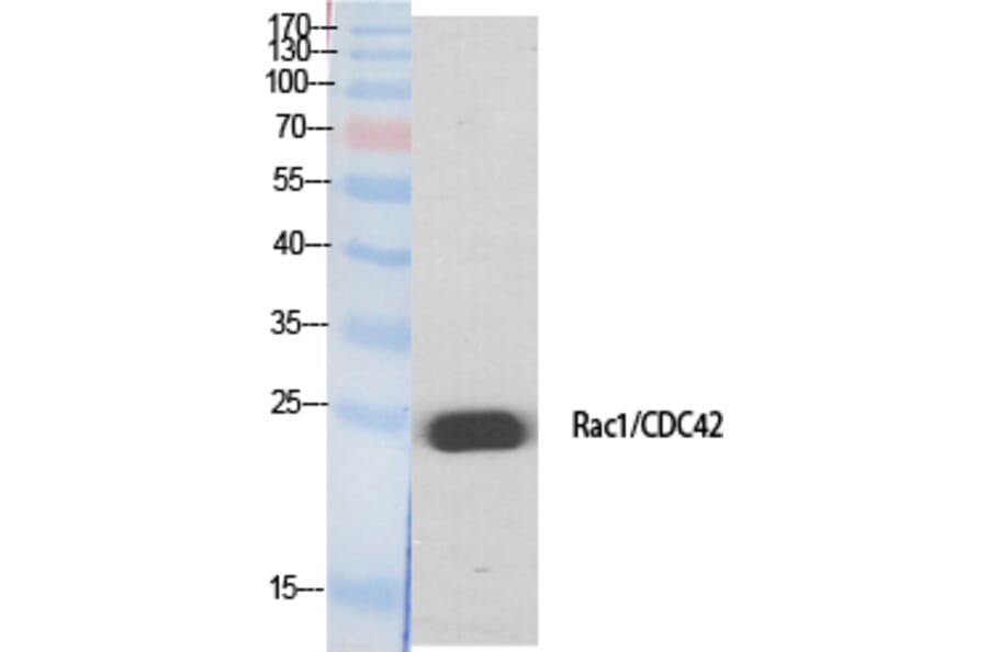 Western Blot - Anti-CDC42 Antibody (B7205) - Antibodies.com