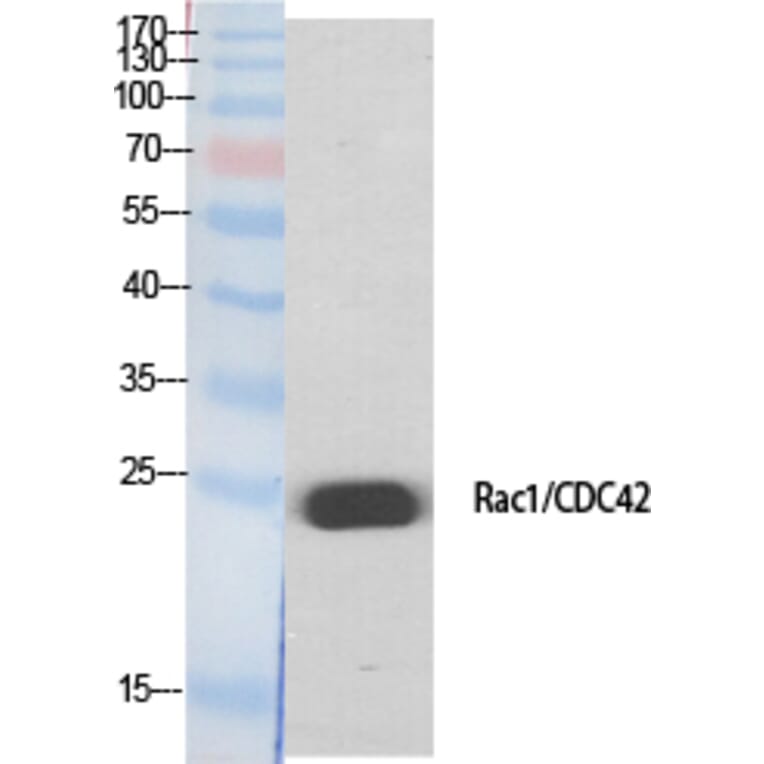Western Blot - Anti-CDC42 Antibody (B7205) - Antibodies.com