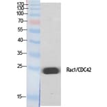 Western Blot - Anti-CDC42 Antibody (B7205) - Antibodies.com