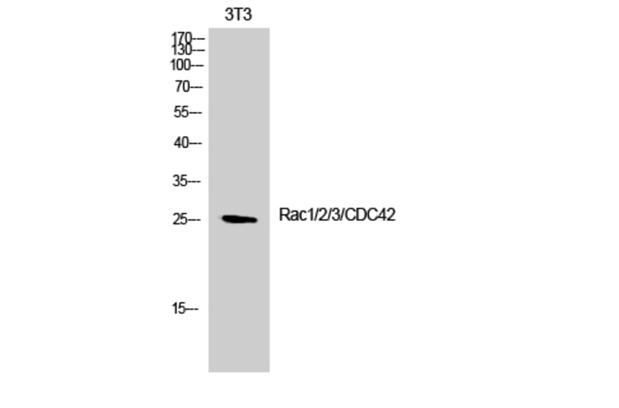 Western Blot - Anti-CDC42 Antibody (B7205) - Antibodies.com