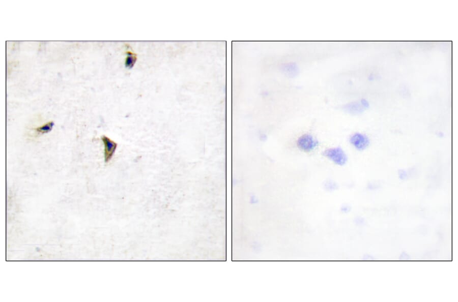 Immunohistochemistry - Anti-KCNB1 Antibody (B1086) - Antibodies.com