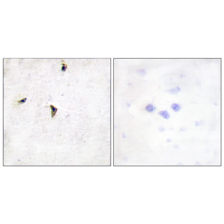 Immunohistochemistry - Anti-KCNB1 Antibody (B1086) - Antibodies.com