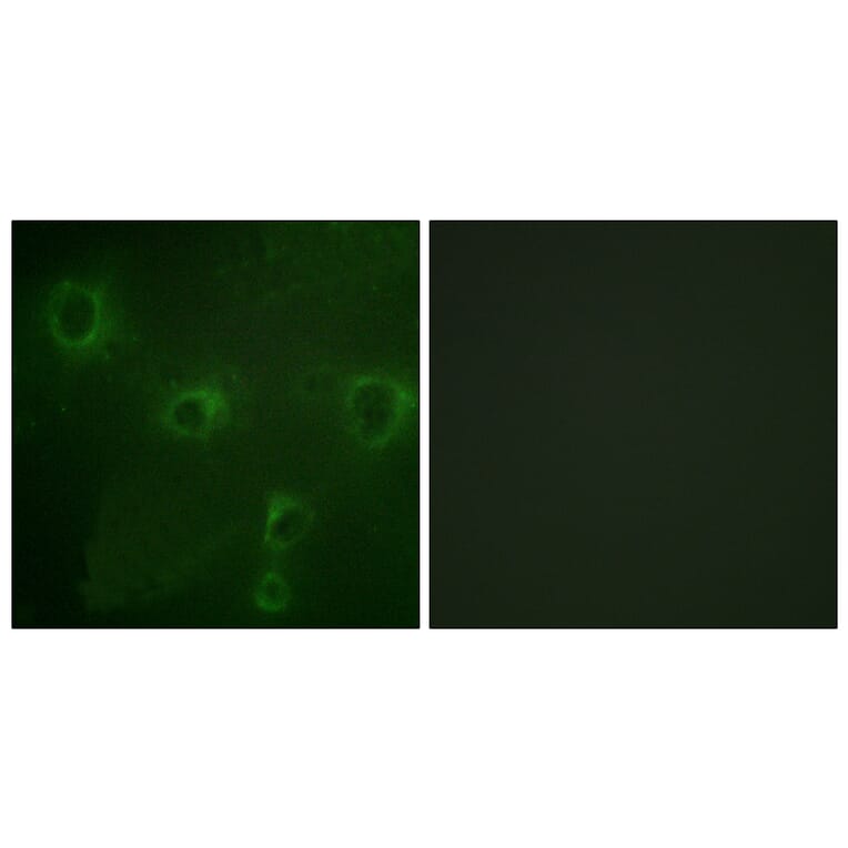 Immunofluorescence - Anti-KCNB1 Antibody (B1086) - Antibodies.com