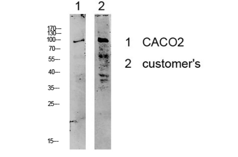 Western Blot - Anti-KCNB1 Antibody (B1086) - Antibodies.com