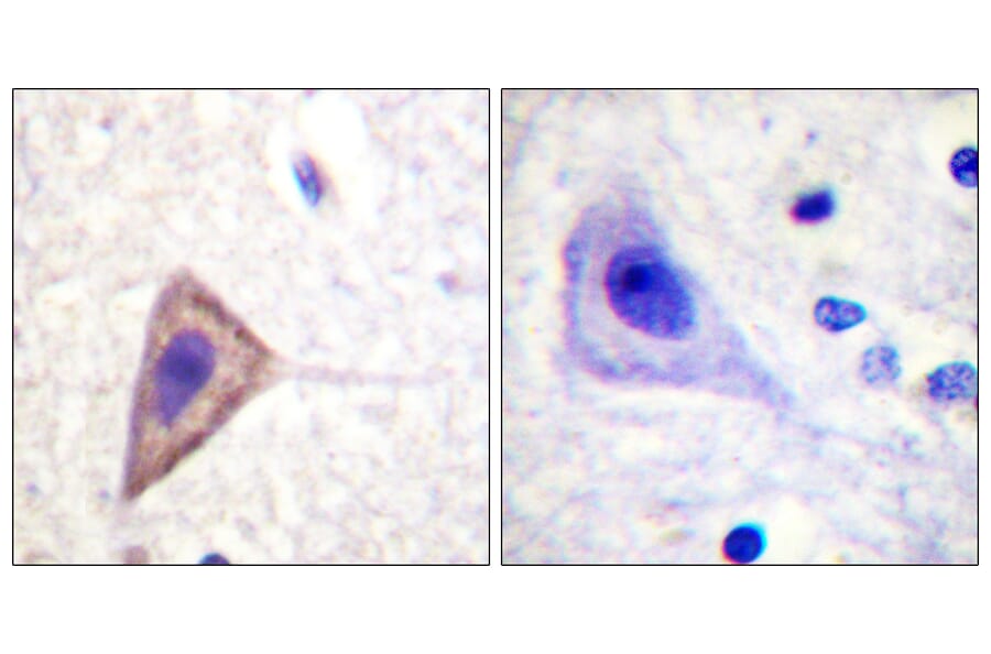 Immunohistochemistry - Anti-KCNA3 Antibody (B1085) - Antibodies.com