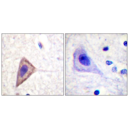Immunohistochemistry - Anti-KCNA3 Antibody (B1085) - Antibodies.com