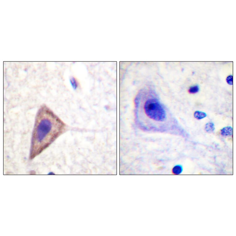 Immunohistochemistry - Anti-KCNA3 Antibody (B1085) - Antibodies.com