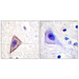 Immunohistochemistry - Anti-KCNA3 Antibody (B1085) - Antibodies.com