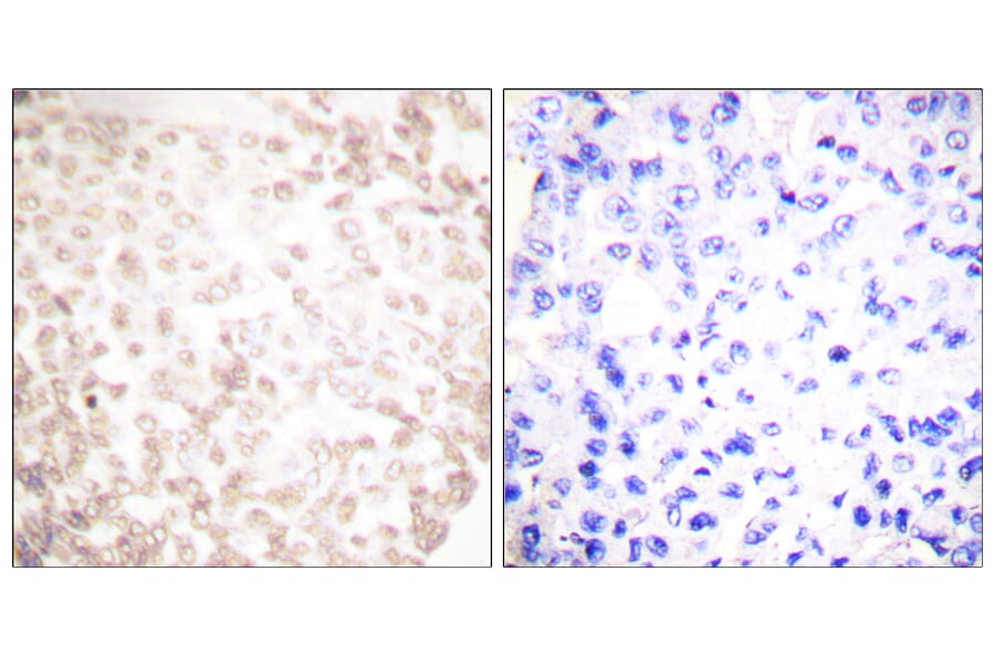 Immunohistochemistry - Anti-XRCC1 Antibody (C0395) - Antibodies.com