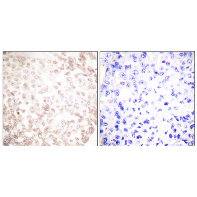 Immunohistochemistry - Anti-XRCC1 Antibody (C0395) - Antibodies.com