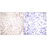 Immunohistochemistry - Anti-XRCC1 Antibody (C0395) - Antibodies.com